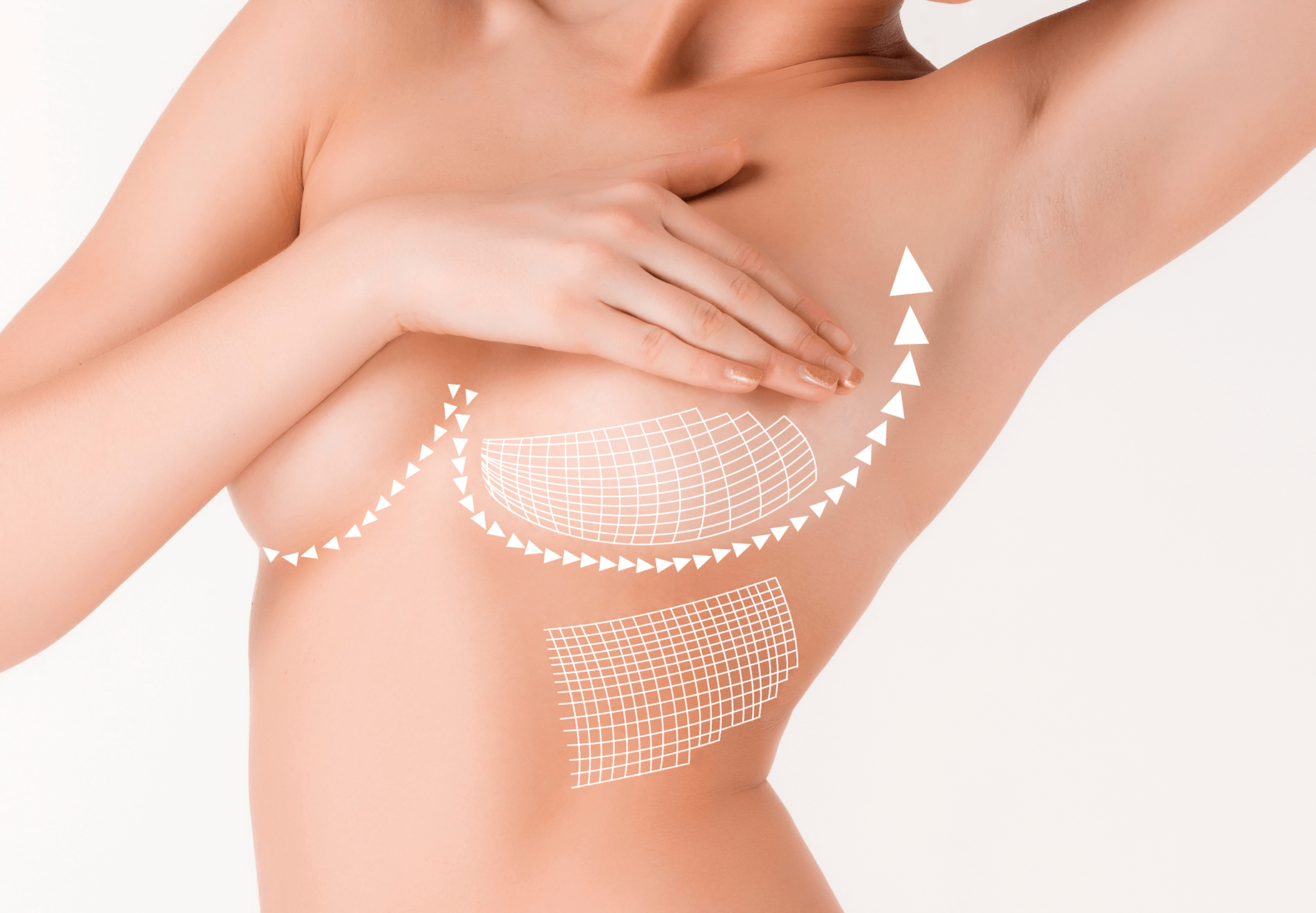 POLYTECH Health & Aesthetics English - Underwire bras can make your breasts  look perky and beautiful but you need to avoid them right after your breast  augmentation! Their structure can irritate your
